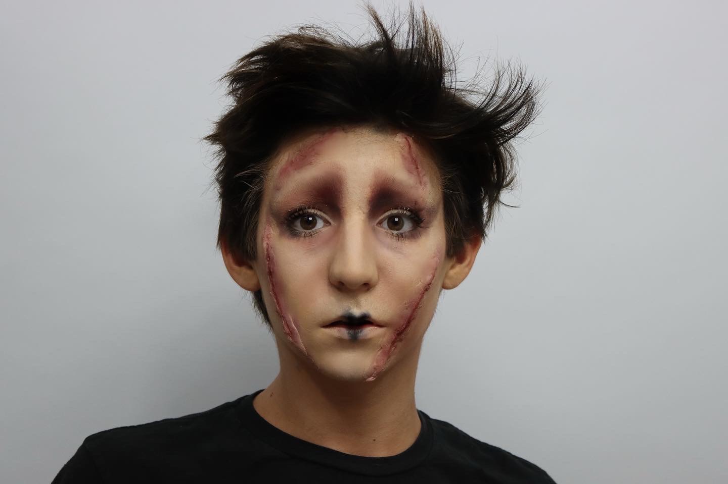 Prosthetic scar work